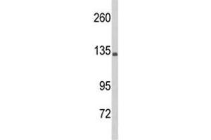 Western Blotting (WB) image for anti-Complement Component 5 (C5) (AA 253-281) antibody (ABIN3029690)