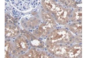 Immunohistochemistry (IHC) image for anti-Glutamic-Oxaloacetic Transaminase 1, Soluble (Aspartate Aminotransferase 1) (GOT1) (AA 1-413) antibody (ABIN7433261)