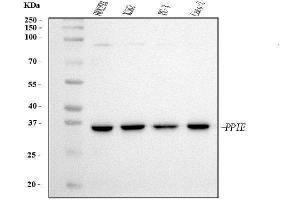 Western blot analysis of Cyclophilin E/PPIE using anti-Cyclophilin E/PPIE antibody (ABIN7599242). (PPIE 抗体  (AA 1-301))