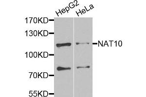 Western blot analysis of extracts of various cell lines, using NAT10 antibody. (NAT10 抗体)