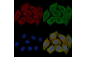 ABIN6256370 and ABIN6267611 staining Hela cells(30 min of UV treatment) by IF/ICC. (LIPE 抗体  (pSer554, pSer855))