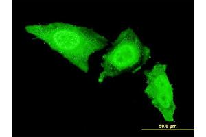 Immunofluorescence of monoclonal antibody to IRAK3 on HeLa cell. (IRAK3 抗体  (AA 497-596))