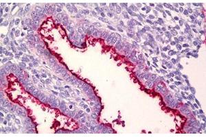 Anti-MUC16 / CA-125 antibody IHC staining of human uterus, endometrium. (MUC16 抗体  (AA 13311-13360))