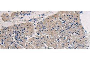 Immunohistochemistry (Paraffin-embedded Sections) (IHC (p)) image for anti-Collagen, Type XVII, alpha 1 (COL17A1) antibody (ABIN7244681)