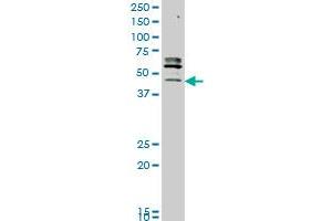 STK32C monoclonal antibody (M05), clone 3E8 Western Blot analysis of STK32C expression in MCF-7 . (STK32C 抗体  (AA 1-369))
