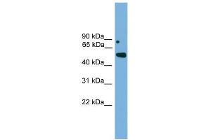 WB Suggested Anti-Irx5 Antibody Titration: 0. (IRX5 抗体  (Middle Region))