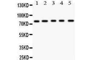 Anti- MCAK antibody, Western blotting All lanes: Anti MCAK  at 0.