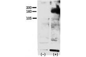 Western blot testing of phospho-ERBB4 antibody and FG pancreatic carcinoma cells treated with or without EGF (50ng/ml) for 15 min. (ERBB4 抗体  (pTyr1162))