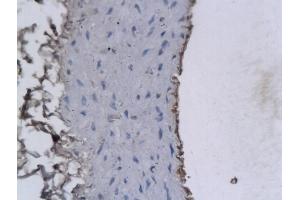 Formalin-fixed and paraffin embedded Rabbit Cartoid labeled with Anti-PAFAH2/Lp-PLA2 Polyclonal Antibody, Unconjugated (ABIN686722) followed by conjugation to the secondary antibody and DAB staining (PLA2G7 抗体  (AA 301-441))