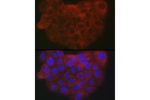 Immunofluorescence analysis of A-431 cells using Collagen I/COL1 antibody (ABIN6134502, ABIN6138839, ABIN6138840 and ABIN6221469) at dilution of 1:25. (COL1A2 抗体  (AA 500-600))