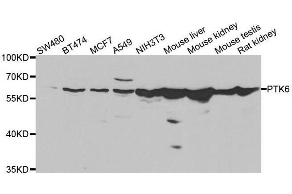 PTK6 抗体  (AA 222-451)