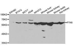 Western blot analysis of extracts of various cell lines, using PTK6 antibody. (PTK6 抗体  (AA 222-451))