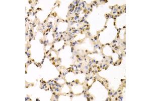Immunohistochemistry of paraffin-embedded rat lung using SFN Antibody. (14-3-3 sigma/SFN 抗体)