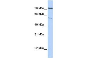 Western Blotting (WB) image for anti-Kinesin Heavy Chain Member 2A (KIF2A) antibody (ABIN2458064) (KIF2A 抗体)