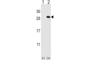 Western Blotting (WB) image for anti-Eukaryotic Translation Initiation Factor 4E Family Member 2 (EIF4E2) antibody (ABIN3001010) (EIF4E2 抗体)