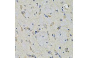 Immunohistochemistry of paraffin-embedded rat brain using RAE1 antibody (ABIN5974056) at dilution of 1/100 (40x lens). (RAE1 抗体)
