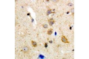 Immunohistochemical analysis of BLK staining in human brain formalin fixed paraffin embedded tissue section. (BLK 抗体  (C-Term))
