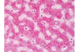 Immunohistochemistry (IHC) image for anti-ATP-Binding Cassette, Sub-Family B (MDR/TAP), Member 5 (ABCB5) (Internal Region) antibody (ABIN349592)