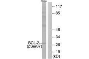 Western blot analysis of extracts from HeLa cells treated with nocodazole 1ug/ml 18h, using BCL-2 (Phospho-Ser87) Antibody. (Bcl-2 抗体  (pSer87))