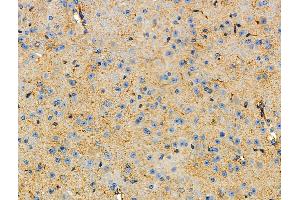 ABIN6264641 and ABIN6277740 at 1/100 staining Mouse brain tissue by IHC-P. (Raptor 抗体  (C-Term))