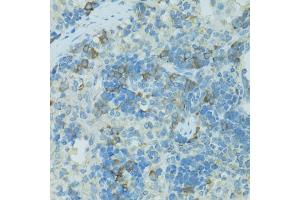 Immunohistochemistry of paraffin-embedded rat spleen using TJP2 antibody. (TJP2 抗体)