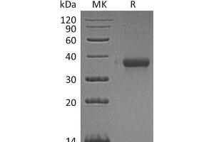 Western Blotting (WB) image for Inositol Monophosphatase Domain Containing 1 (IMPAD1) protein (His tag) (ABIN7320825) (IMPAD1 Protein (His tag))