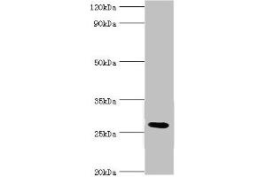 Western blot All lanes: C4b-binding protein beta chain antibody at 6 μg/mL + Mouse liver tissue Secondary Goat polyclonal to rabbit IgG at 1/10000 dilution Predicted band size: 28 kDa Observed band size: 28 kDa (C4BPB 抗体  (AA 18-252))