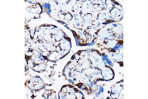 Immunohistochemistry of paraffin-embedded Human placenta using p38 MAPK Rabbit pAb (ABIN7268615) at dilution of 1:100 (40x lens). (MAPK14 抗体  (AA 1-360))