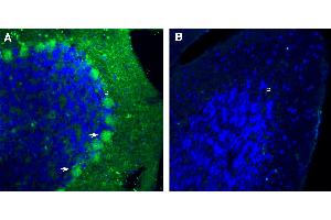Free-floating frozen brain sections from a paraformaldehyde-perfused mouse were incubated with Anti-Plexin B1 (extracellular) Antibody (ABIN7885236, 1:300), followed by goat anti-rabbit secondary antibody conjugated to Alexa Fluor® 488 (green). (PLXNB1 抗体  (Extracellular, N-Term))