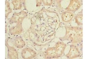 Immunohistochemistry (IHC) image for anti-Coiled-Coil Domain Containing 108 (CCDC108) (AA 2-164) antibody (ABIN7147772)