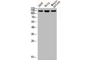 Western blot analysis of 293T Hela mouse-spleen lysis using Phospho-IRS-1 (S312) antibody. (IRS1 抗体  (pSer312))