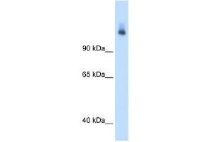WB Suggested Anti-CPS1 Antibody Titration:  1. (CPS1 抗体  (N-Term))