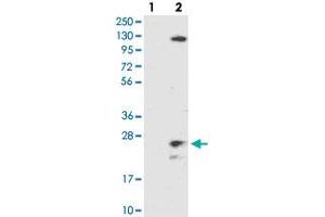 Western blot analysis of Lane 1: Negative control (vector only transfected HEK293T lysate), Lane 2: Over-expression Lysate (Co-expressed with a C-terminal myc-DDK tag (~3. (TMEM186 抗体)