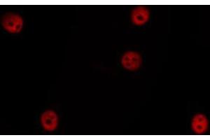 ABIN6266524 staining HepG2 by IF/ICC. (Cyclin E1 抗体  (C-Term))