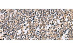 Immunohistochemistry of paraffin-embedded Human tonsil tissue using CSRP2 Polyclonal Antibody at dilution of 1:60(x200) (CSRP2 抗体)