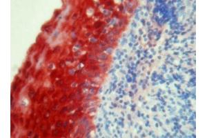 Immunohistochemistry on human tonsil paraffin sections using S100A8 antibody clone 8-5C2.