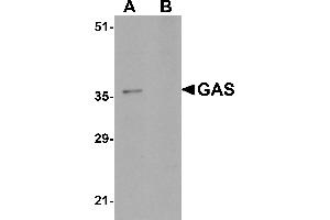 Western blot analysis of GAS in EL4 cell lysate in (A) the absence and (B) the presence of blocking peptide with GAS antibody at 1µg/mL.