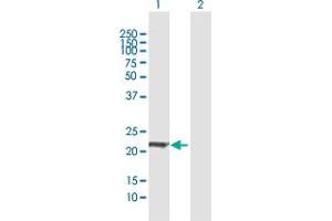 Western Blot analysis of ARL11 expression in transfected 293T cell line by ARL11 MaxPab polyclonal antibody. (ARL11 抗体  (AA 1-196))