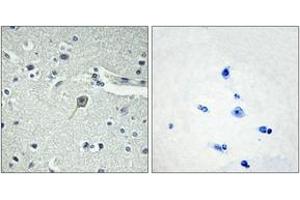 Immunohistochemistry analysis of paraffin-embedded human brain tissue, using PTHR1 Antibody. (PTH1R 抗体  (AA 145-194))