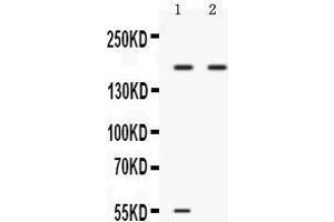 Western blot analysis of Ceruloplasmin expression in 22RV1 whole cell lysates (lane 1) and A549 whole cell lysates (lane 2).
