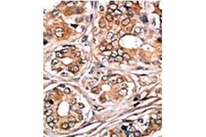 Image no. 1 for anti-Retinoblastoma 1 (RB1) (pSer780) antibody (ABIN358213) (Retinoblastoma 1 抗体  (pSer780))