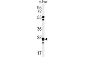 Western Blotting (WB) image for anti-Glutathione S-Transferase kappa 1 (GSTK1) antibody (ABIN3004354) (GSTK1 抗体)