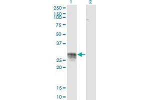 Western Blot analysis of CD83 expression in transfected 293T cell line by CD83 monoclonal antibody (M01), clone 3G10-1F4. (CD83 抗体  (AA 1-205))