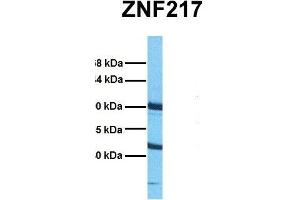 Host:  Rabbit  Target Name:  ZNF217  Sample Tissue:  Human HepG2  Antibody Dilution:  1. (ZNF217 抗体  (Middle Region))
