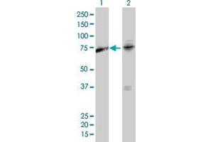 Lane 1: AKAP10 transfected lysate ( 74 KDa). (AKAP10 HEK293 Cell Transient Overexpression Lysate(Non-Denatured))