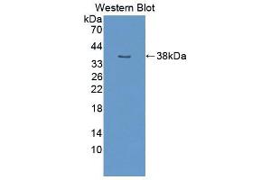 Western blot analysis of the recombinant protein. (NUP50 抗体  (AA 134-393))