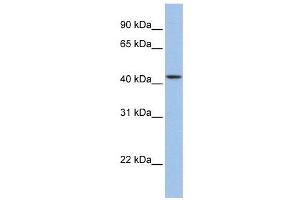 WB Suggested Anti-ZNF202  Antibody Titration: 0. (ZNF202 抗体  (Middle Region))