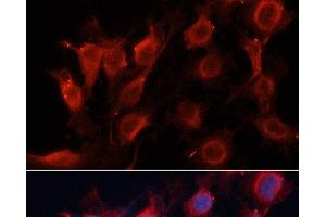 Immunofluorescence analysis of HUVEC cells using VEGF Polyclonal Antibody at dilution of 1:100 (40x lens). (VEGF 抗体)