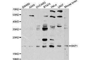 Western blot analysis of extracts of various cell lines, using SKP1 antibody. (SKP1 抗体  (AA 1-163))