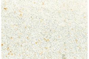 ABIN6259839 and ABIN6276707 at 1/100 staining Rat brain tissue by IHC-P.